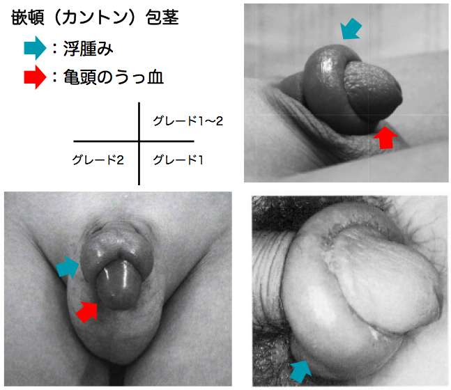 ドラゴンカーセックスの際、興が乗ってしまいうっかりケレウさんに傷をつけてしまうザバカーシュさんとか…… | 鳴蚊嶋五連🔞  (@nakagore)さんへのお題