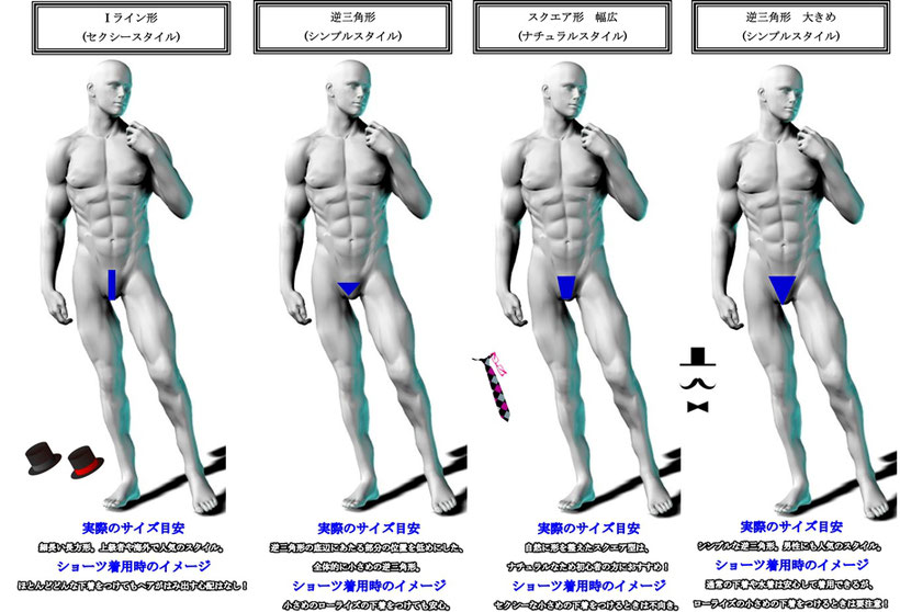 【メンズVIO脱毛の照射範囲を紹介！VIOの回りも照射もお勧めしたい理由は？】医療脱毛するなら湘南AGAクリニック大阪院！