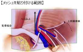 オイルリンパマッサージ 鼠径部 福岡