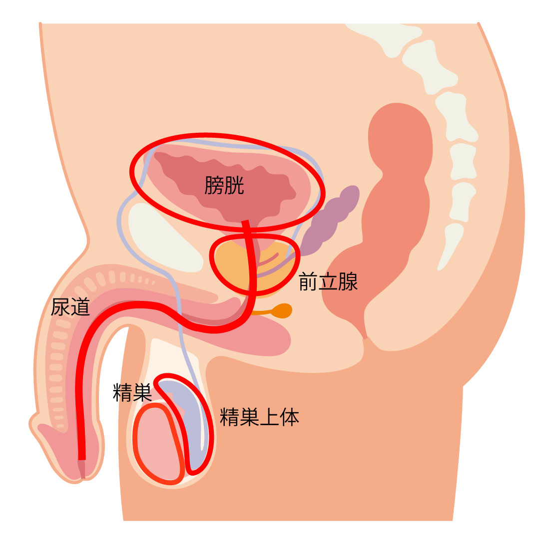 女性の肛門疾患｜大阪市住吉区あびこ駅前の肛門外科 むらやま大腸肛門クリニック