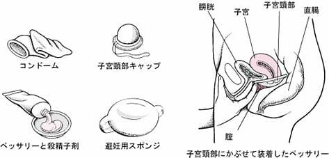 梅毒について | あおぞら研究所