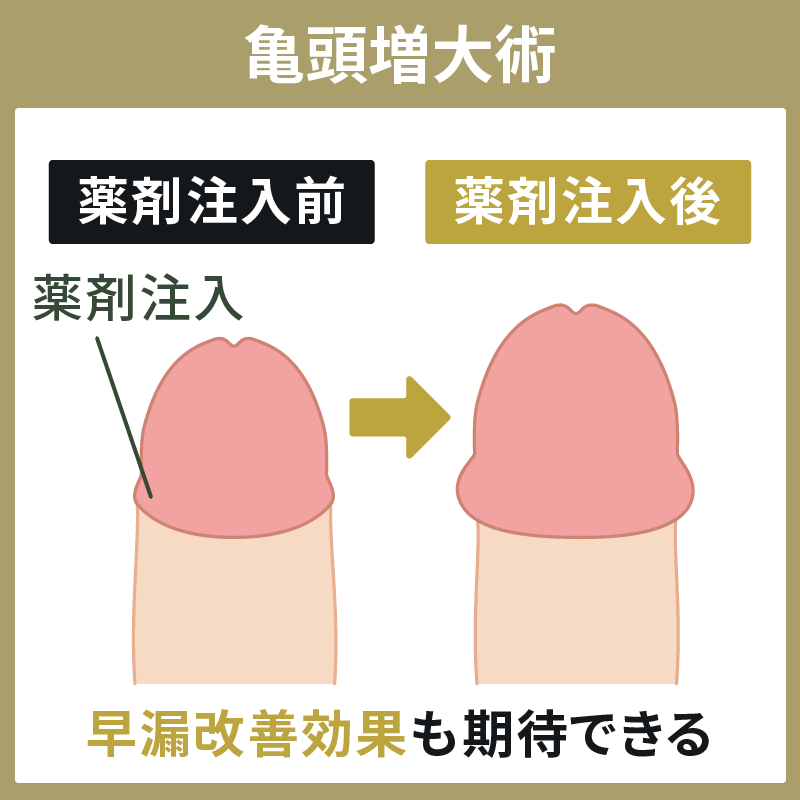 男性のアンダーヘア（陰毛）のちょうど良い長さは？おすすめの処理方法も紹介 | メンズ脱毛百科事典