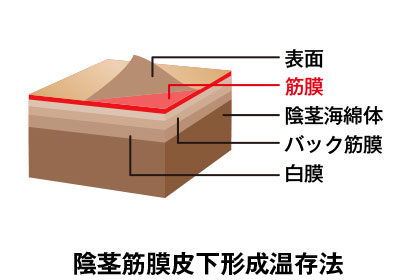 アトムクリニックの切らない包茎手術・長茎術の口コミ・評判は？4,800円(税込)で受けられる？費用と施術方法をわかりやすく解説 - まちかど薬局情報館