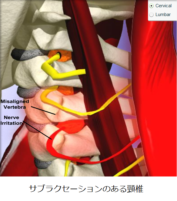 肩インピンジメント症候群の基礎知識と運動×機能解剖学 ｜ XPERT