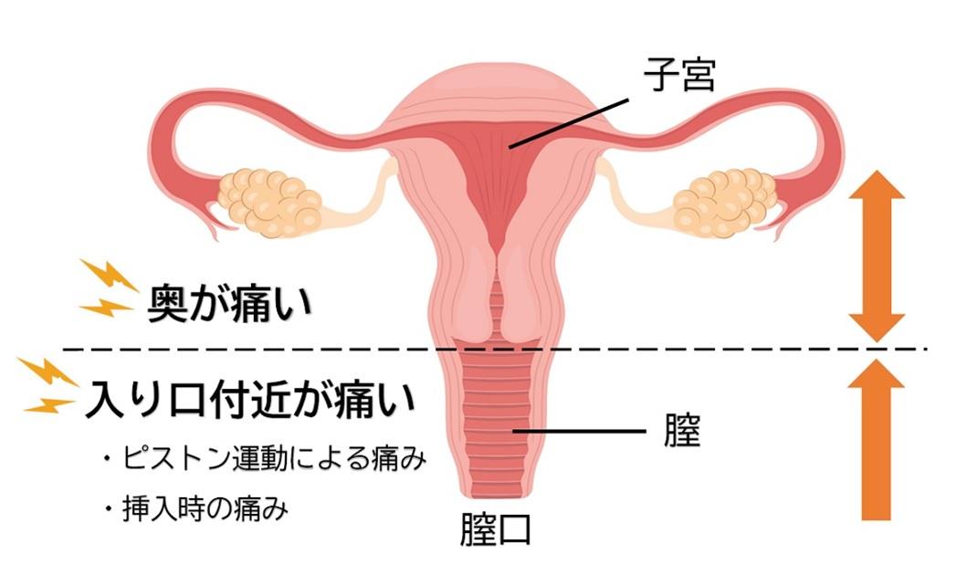 たった2つのコツで後背位（バック）は圧倒的に上手くなる！やり方を徹底解説｜駅ちか！風俗雑記帳