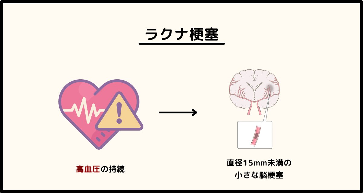 ChatGPT活用！アナロジーから着想するアイデア発想法 - DESIGN