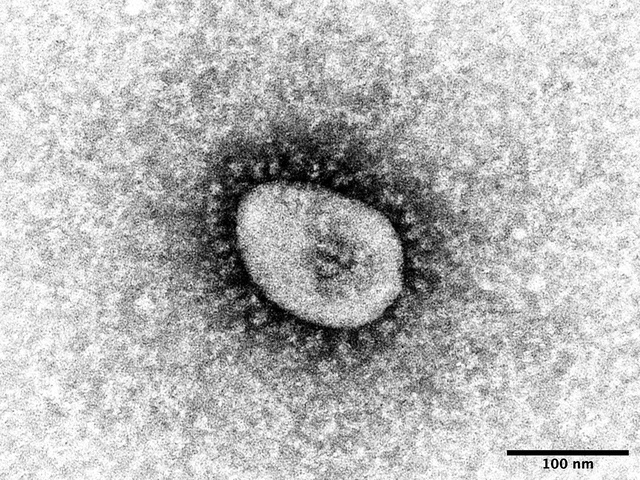 オミクロン株の症状・重症化や感染力などは BA.1 BA.2 BA.2.75 BA.4