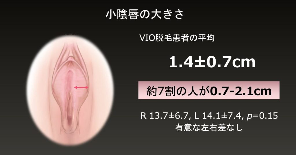 小陰唇縮小術｜びらびらを切除する婦人科形成｜新宿駅前婦人科クリニック【東京】