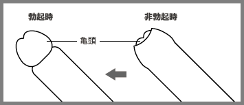 真性包茎とは｜上野クリニック