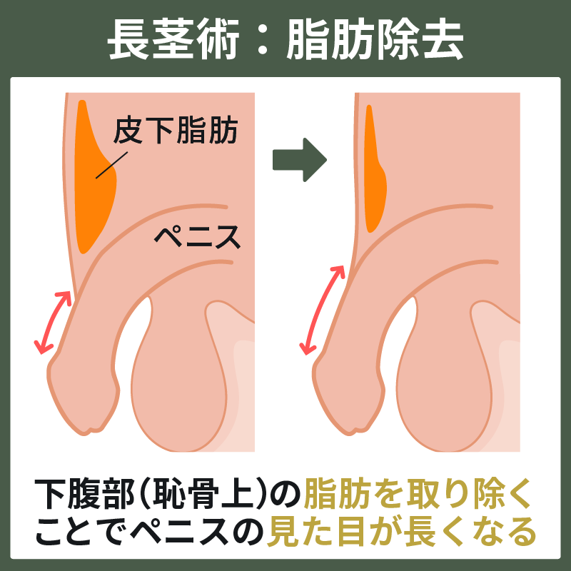 自分の勃起したチンポが一番好き | 男性生殖器マニア