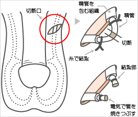 胸筋のセルフマッサージのやり方解説！肩こりの原因「巻き肩」を改善 | 癒しタイムズ