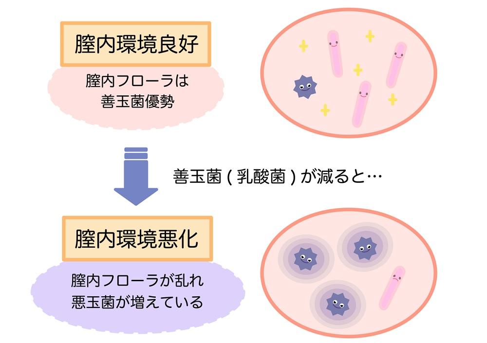 細菌性腟症 | ジャスミンレディースクリニック渋谷・新宿・池袋・東京・大宮