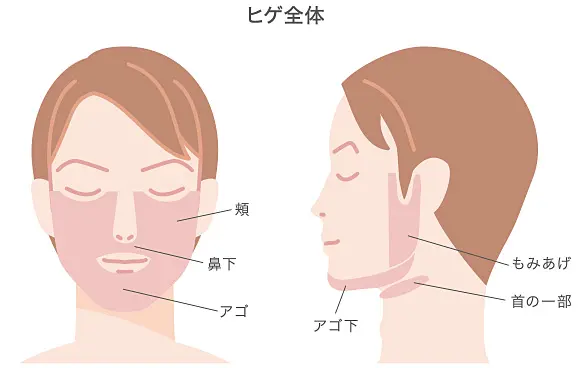 ヒゲ脱毛は1回で完了する？脱毛方法ごとの回数の違いやヒゲの減り方を解説 | メンズ脱毛百科事典 リンクスペディア