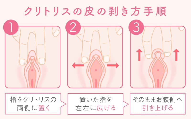 クリトリス包茎 | ゆかりレディースクリニック 神戸市三宮にある婦人科