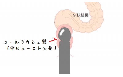 S状結腸開発用アナルビーズ色々 | 電マ好き