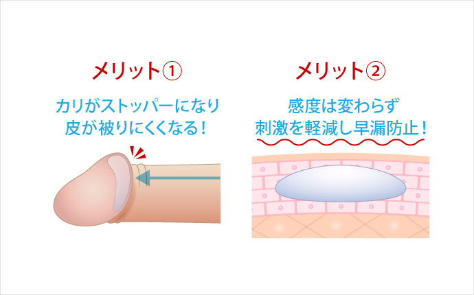 泌尿器専門医が解説】異物を入れずにカリ高ペニスを作る唯一の方法