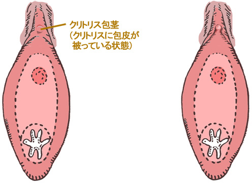 クリトリスの皮を剥くコツは？クリイキするための正しい剥き方をイラストでチェック