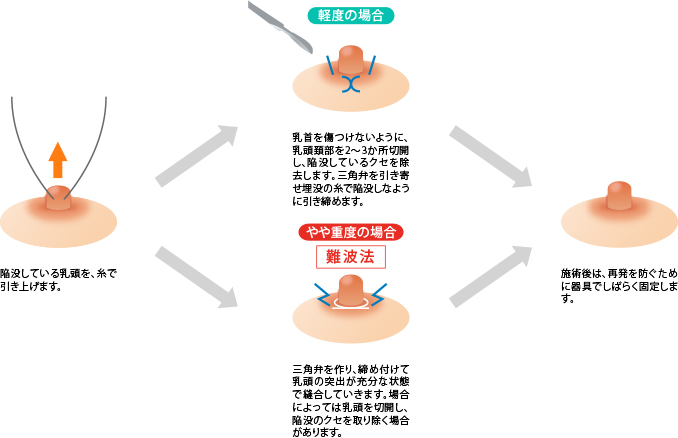 乳首 - Wikipedia