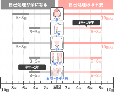 リゼクリニックは充実の全身脱毛プランが魅力！ 特徴や料金などを紹介 | 医療脱毛