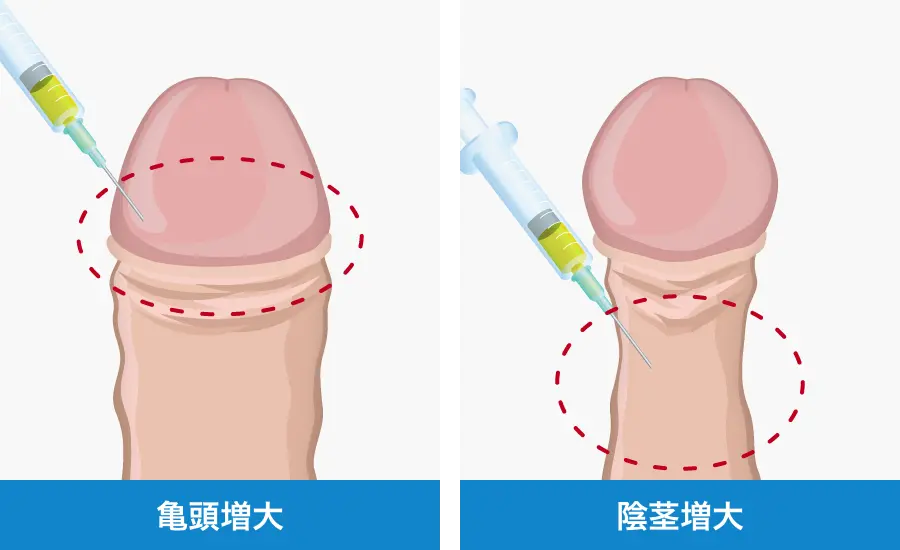 自宅で実践可能】科学に基づくペニス増大トレーニング〇つ | STERON