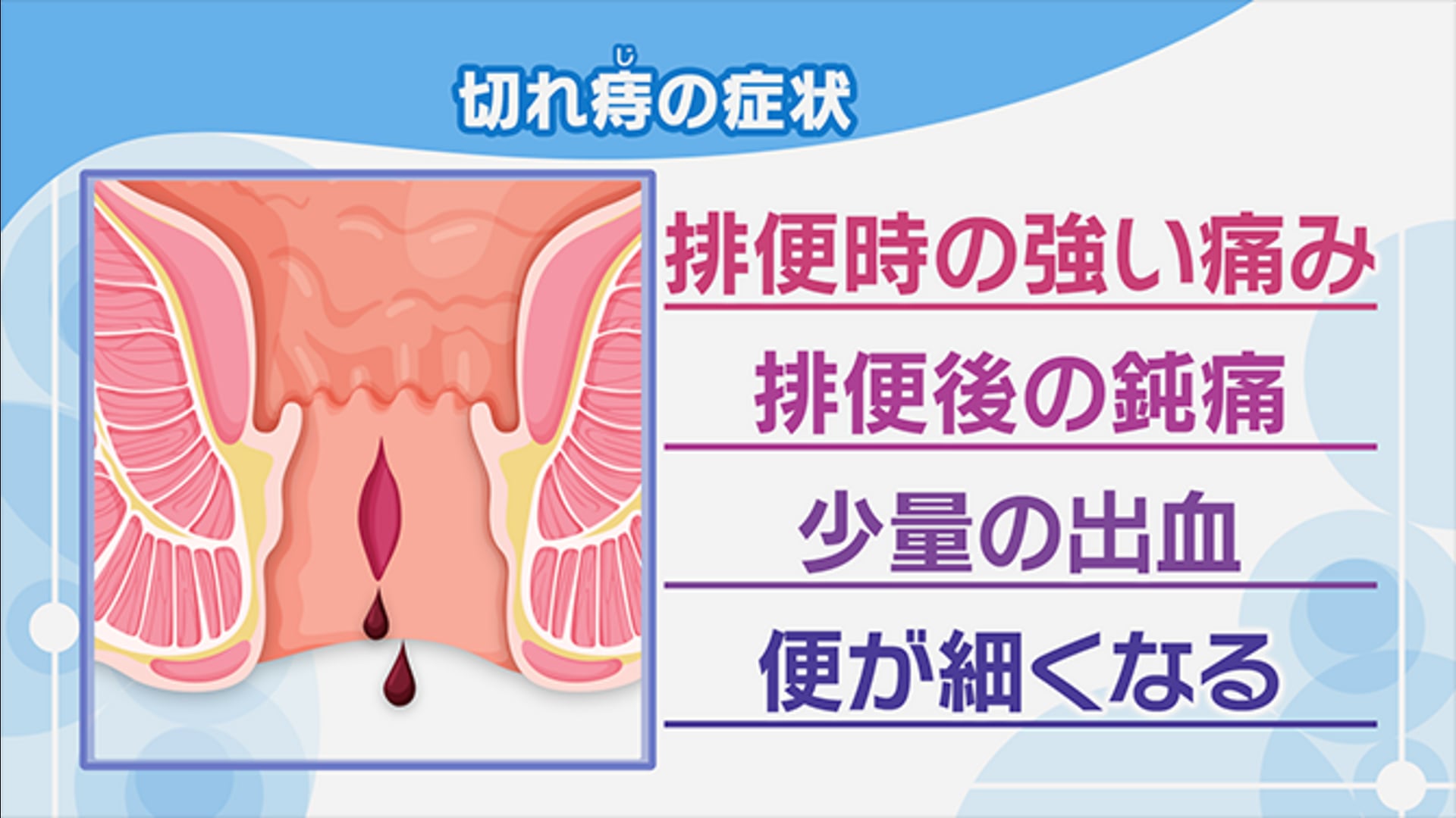 性感染症についての解説コラム | GME医学検査研究所