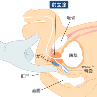 アナニーのやり方１つで超絶気持ちよくするコツを１０個紹介