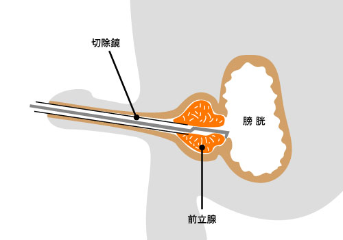 オナニーをもっと気持ちよくするための３つの方法と注意点| PHC Ladies