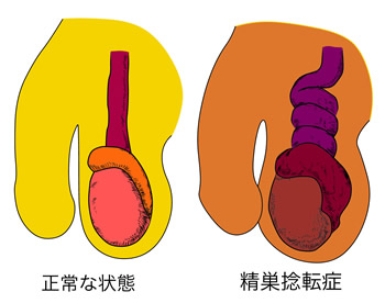 性器ヘルペス感染症の原因と症状 - 治し方と治療薬について|天神マイケアクリニック