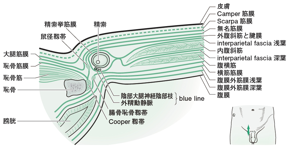 鼡径部痛症候群（グロインペイン症候群）について【金沢市アルコット接骨院】