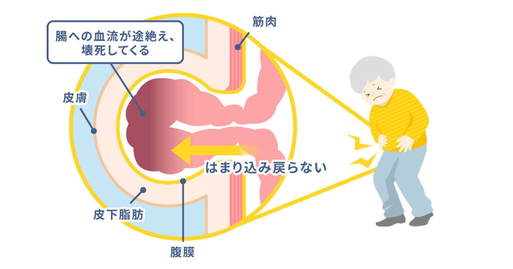 4ページ目｜リンパ 鼠径部 マッサージに関するサロン