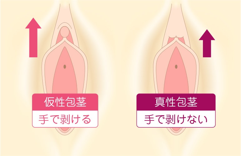 クリトリス系性感帯 Uスポットの開発と刺激方法 上級者編 |