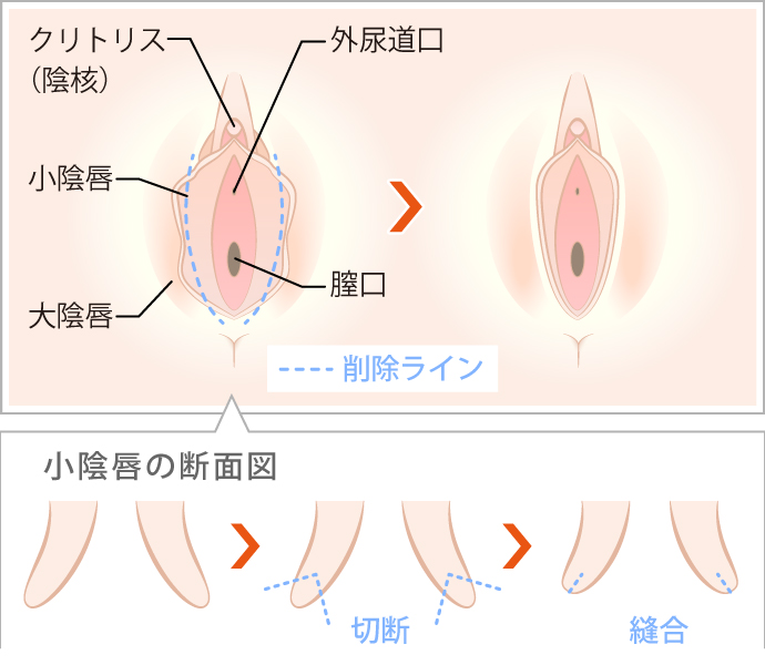 性感～「女性器のクリの剥き方はこう」ネットの情報を鵜呑みにするのは危険 | 琴莉オフィシャルブログ