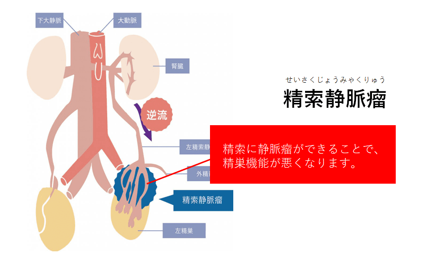 射精障害 | もっと知ってほしいがんと生活のこと