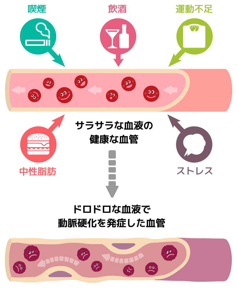 中折れ対策まとめ！セックス中に萎える人は改善策を試さないとヤバイ | ザヘルプM