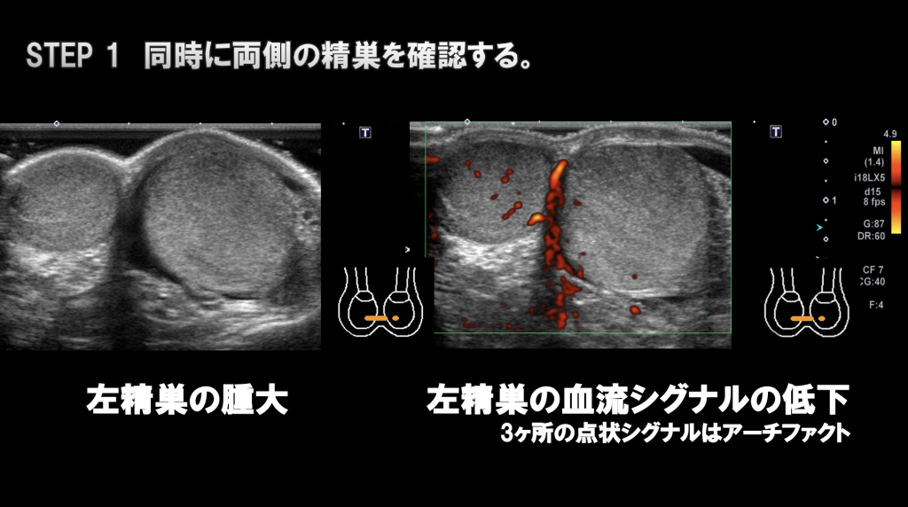 全22種類】勃起力アップするツボ総まとめ！写真付きで刺激方法を徹底解説 | ザヘルプM