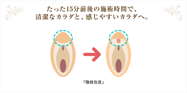 いまこそ、大人の性教育。【Lesson #1】「女性器について知ろう」場所や名前、セルフチェックの方法も。 |