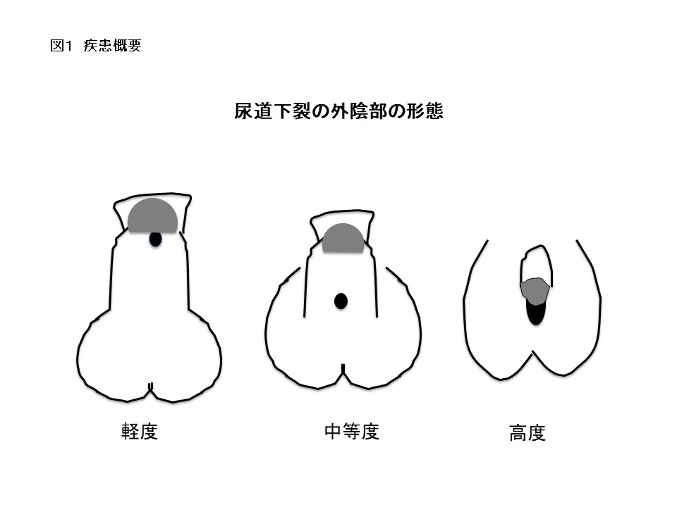 仮性包茎男子におすすめのオナニーのやり方｜知らないとヤバい「皮オナ」危険性とは