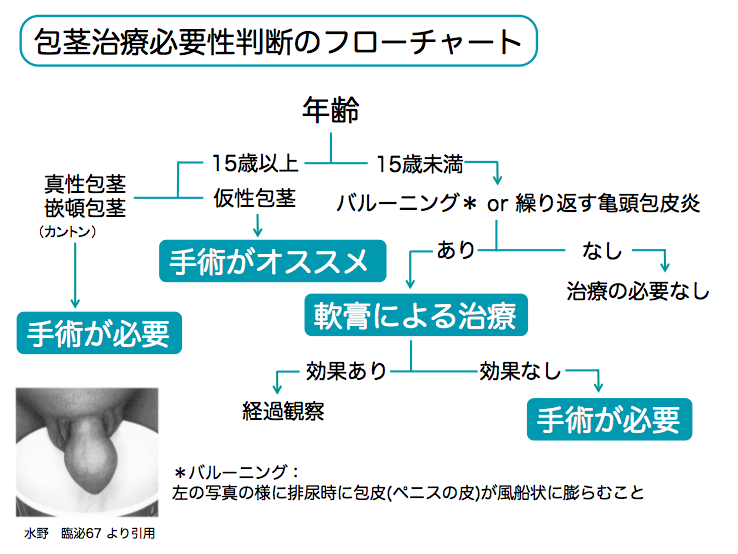 【包茎手術体験談2024総集編 Vol１】手術決断理由 / 上野クリニック選択理由　#ほうけい手術, 上野クリニック公式チャンネルです。,