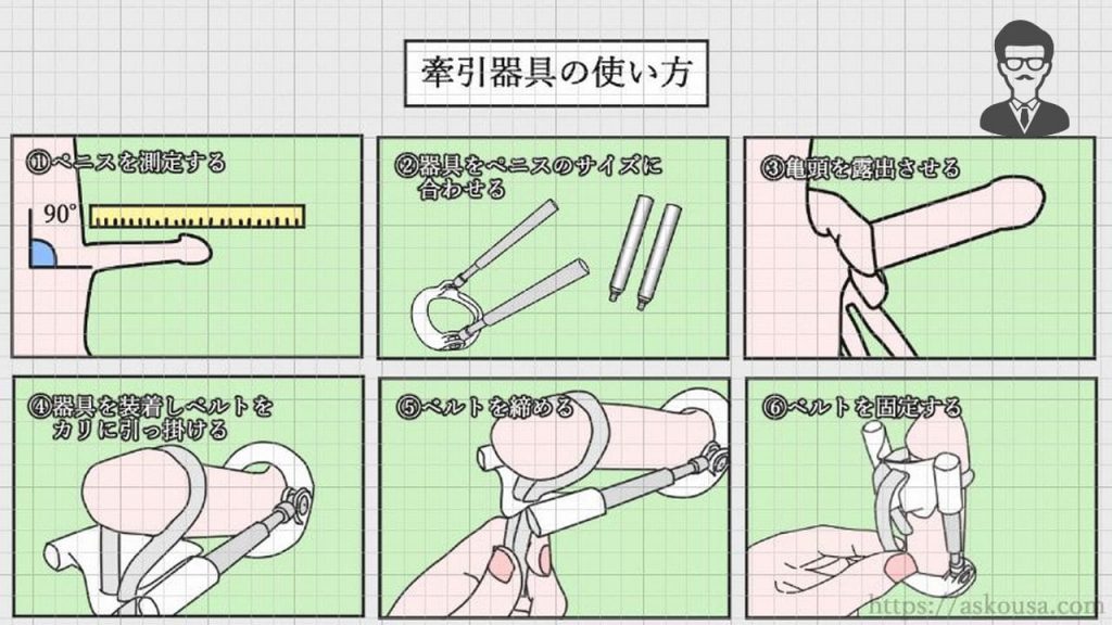 勃起を監視するコンドーム型デバイス ペニスの長さと円周を測定、遠隔医療に活用：Innovative Tech（2/2 ページ）