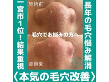 歌舞伎町の立ちんぼホームレス女性まなみさん、1回15000円で客を取り月50万稼ぐも全額ホストに消えている