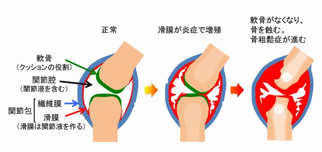 かみ合わせとは｜歯科タウン