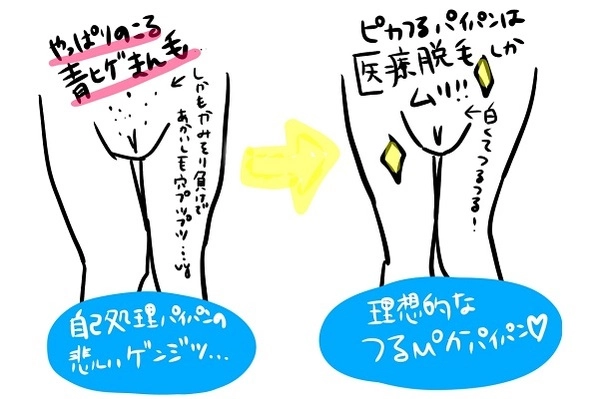 男性がパイパンにするメリットと注意点とは？処理方法まで丁寧に解説をしていきます│メンズジェニー