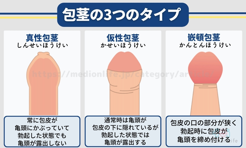 包茎 | 診療案内