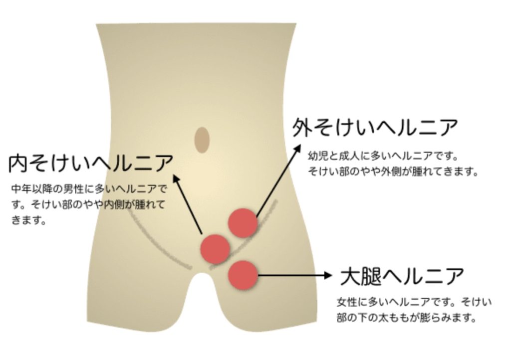 ギフト用】百年ショーツ【藤×珈琲 2枚1組・Lサイズ 】 日本製栃木の工場直売 縫心オリジナル下着