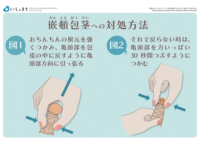 教えて！男の子の性器の洗い方・皮の剥き方やケアの方法（赤ちゃん～幼児頃） | 家庭ではじめる性教育サイト命育