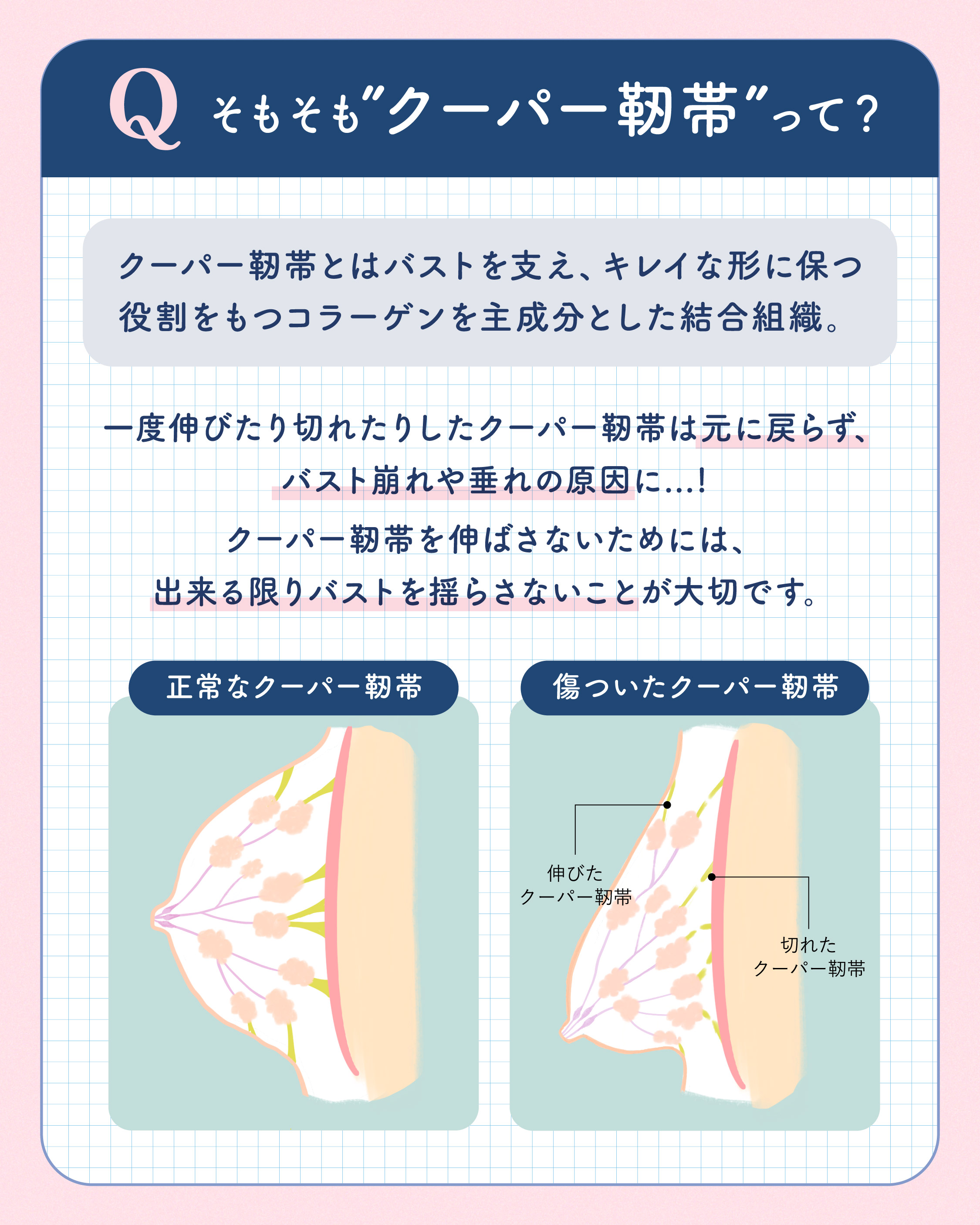 クーパー靭帯！伸びたら切れたら戻らない！？ | ブログ