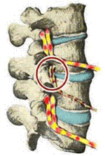 Galeazzi Fracture: What Is