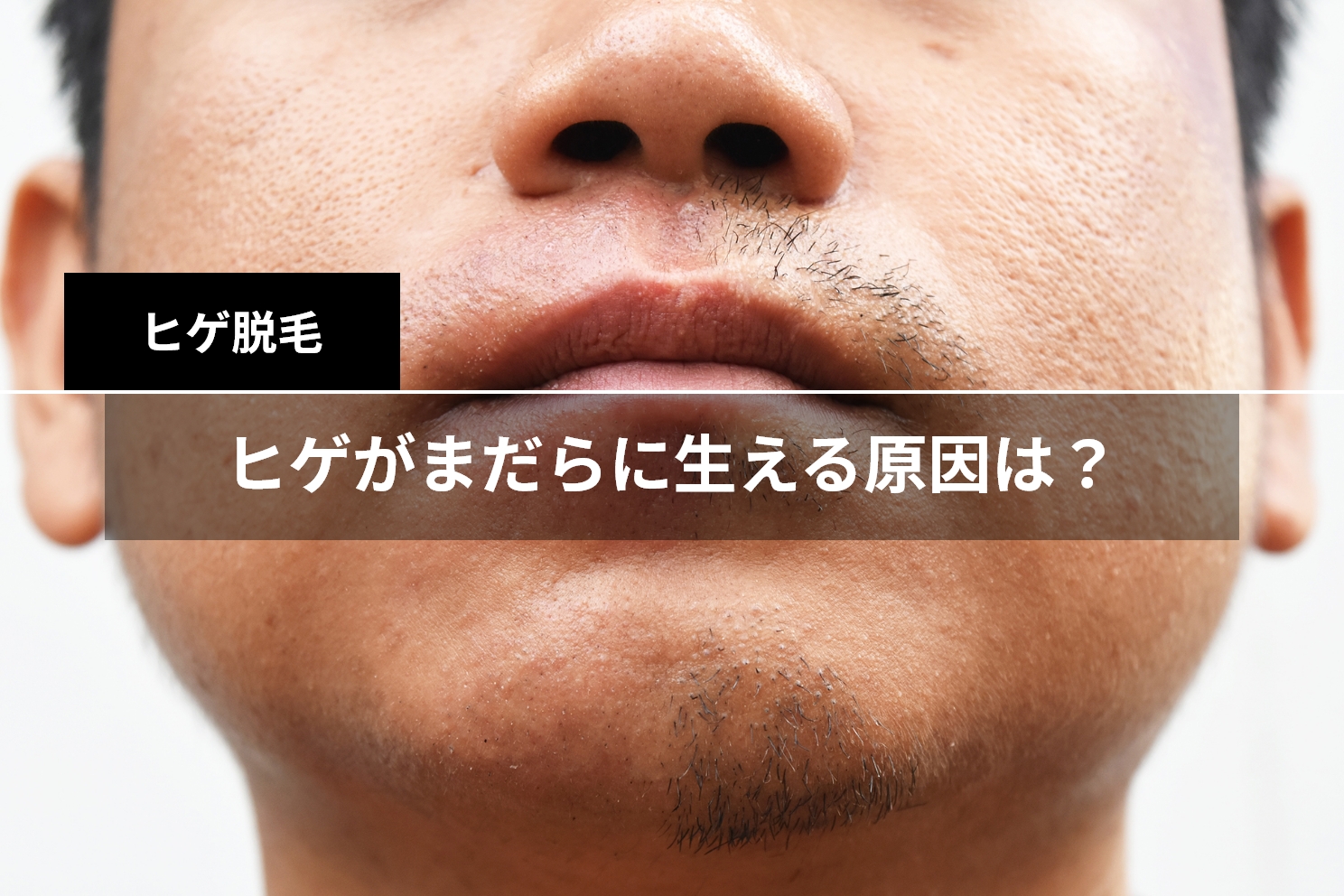 本当に髭を抜くのはよくない？16年以上抜き続けた話【実は薄く…】 - YouTube