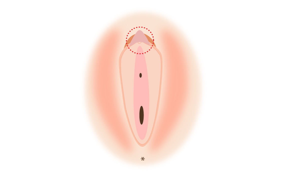 陰部(女性）のできもの・しこりの原因と検査、治療薬（画像あり）|天神マイケアクリニック