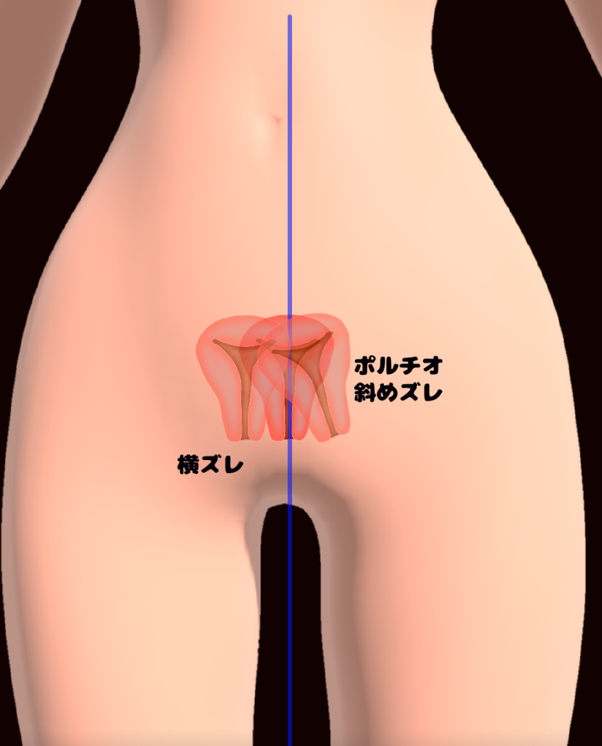 ポルチオセックスのやり方！ ポルチオ開発で奥イキするコツ※体験談あり |